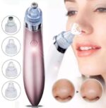 Basilica Blackhead Remover